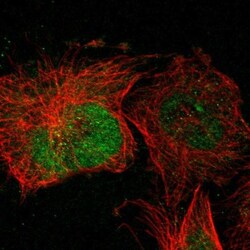 POMK/SGK196 Antibody, Novus Biologicals 0.1mL; Unlabeled:Antibodies, Polyclonal